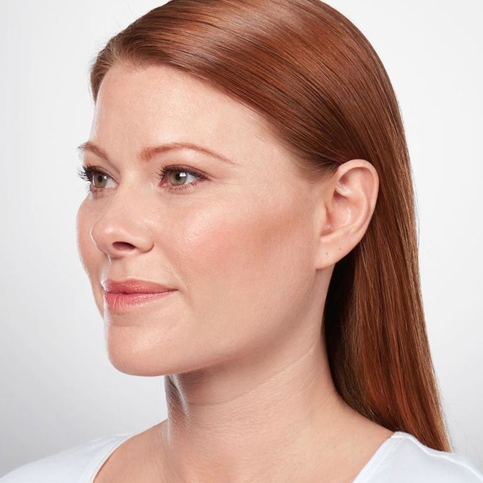 after kybella for double chin