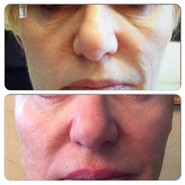 Before And After Photos | Beauty Religion