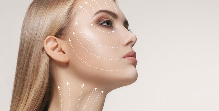 PDO Thread Lift: What You Need to Know
